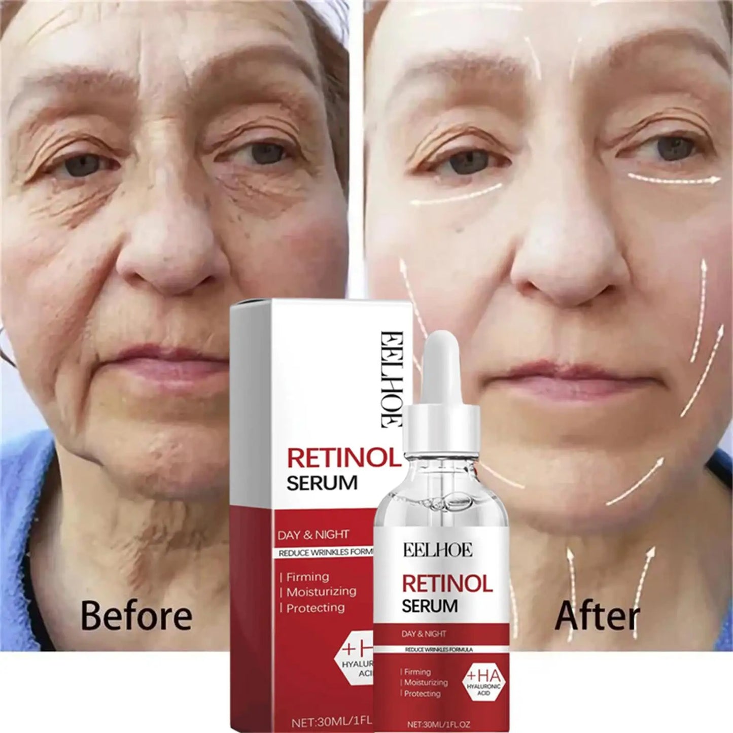 Retinol Wrinkle Repair Set