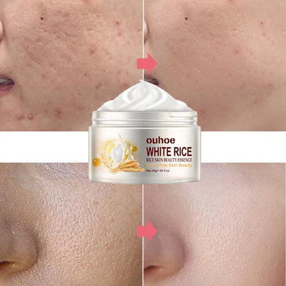 Rice Anti-Wrinkle Cream: Acne, Whitening & Lifting - 30g